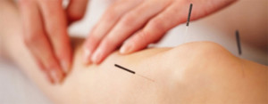 Acupuncture Thornhill